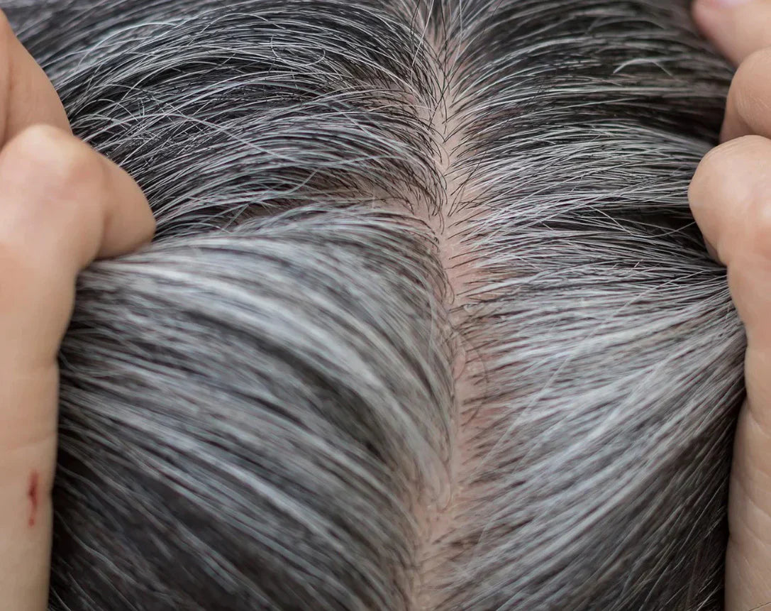 Greying