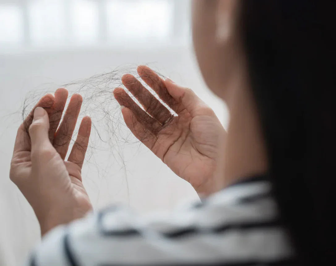 Postpartum Hairloss